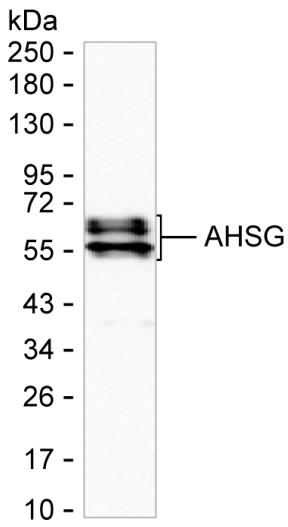 AHSG